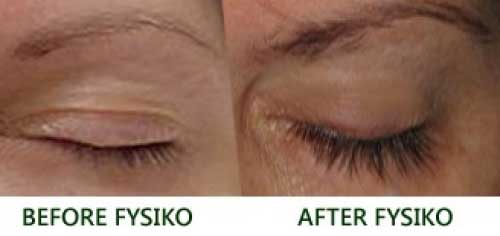 Fysiko-before-and-after